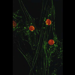  細胞周期阻害剤によって形態が正常化したがん細胞:一般にがん細胞は正常細胞に比べ盛り上がった形態をしているが、新しい細胞周期阻害剤(ラディシコール)によって正常細胞に近い扁平な形態に変化する。 写真はあるがん遺伝子で悪性形質転換した細胞を薬剤処理したのちに蛍光顕微鏡観察したもので、赤い部分が核、緑が新たに出現した正常細胞に特有のアクチン緊張繊維である。